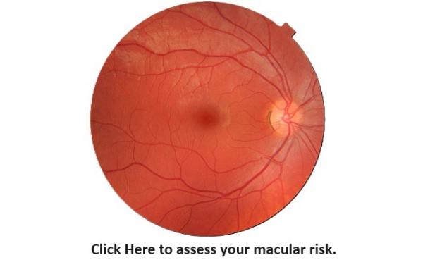 click here to assess your macular risk